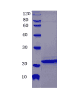 Human Multidrug resistance- associated protein 4, MRP4 Protein